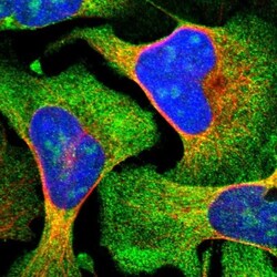 ZCCHC7 Antibody, Novus Biologicals 0.1mL; Unlabeled:Antibodies, Polyclonal